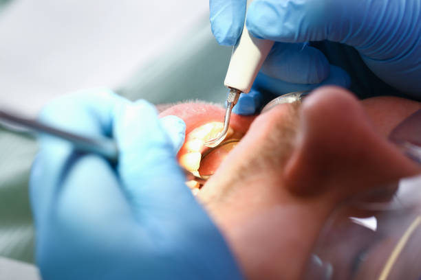 Best Root Canal Emergency Dentist  in Shavertown, PA